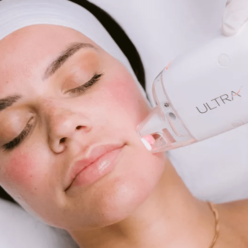 Services_Ultra-min-65b3b5a2